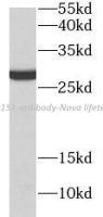 CD151 antibody