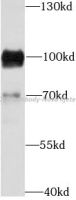 CD19 antibody