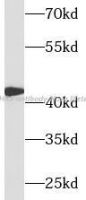 CFHR3 antibody