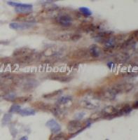 DNA2 antibody