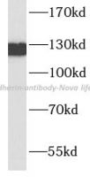 E-cadherin antibody