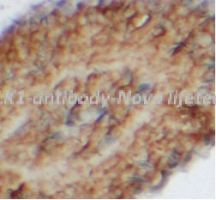 ELK1 antibody