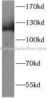 EML4 antibody