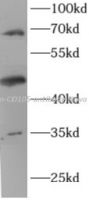 Endoglin/CD105 antibody