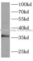 LAT antibody