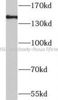 LRIG1 antibody