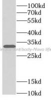 Luciferase Antibody