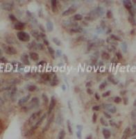 MED1 antibody