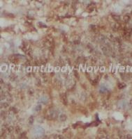 NCOR1 antibody