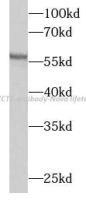 OXCT1 antibody