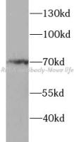 p65/RELA antibody