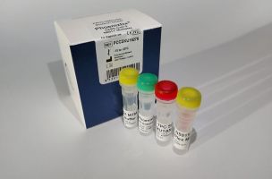 PHOENIXDX® SARS-COV-2 MUTANT SCREEN [N501Y]  is a real-time RT-PCR-based diagnostic